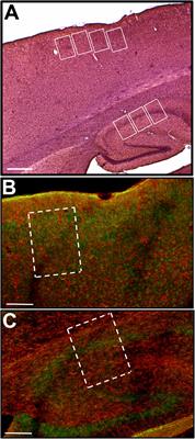 Taurine/Pilocarpine Interaction in the Malnourished Rat Brain: A Behavioral, Electrophysiological, and Immunohistochemical Analysis